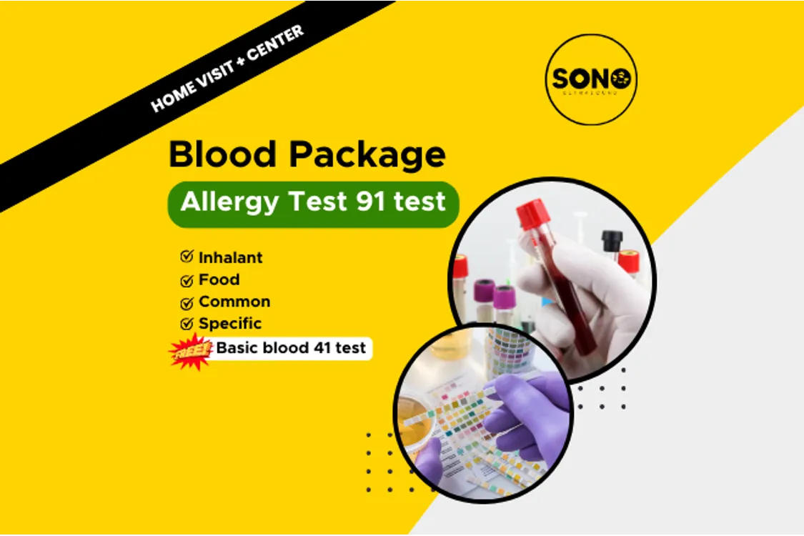 Allergy Test 91 with FREE Basic Blood & Urine Test 